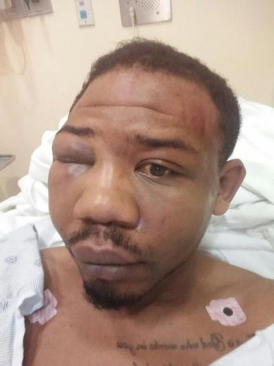 Photo of Hubbert after viral beating by Euclid police